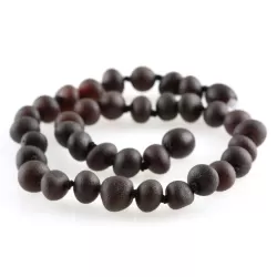 Raw Cherry Baltic Amber Anklets 25cm