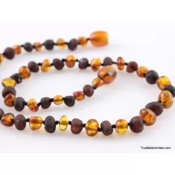 Healing Baby Baltic Amber Teething Necklace