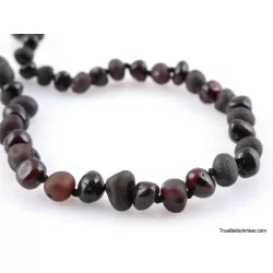 Healing Baby Baltic Amber Teething Necklace