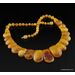 Vintage Egg Yolk pieces Baltic amber choker 17in