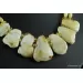 Vintage unique pieces Baltic amber choker 18in